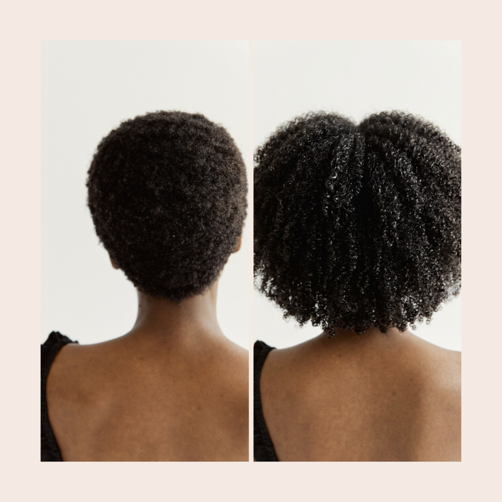 Shampoing à base d'oignon rouge